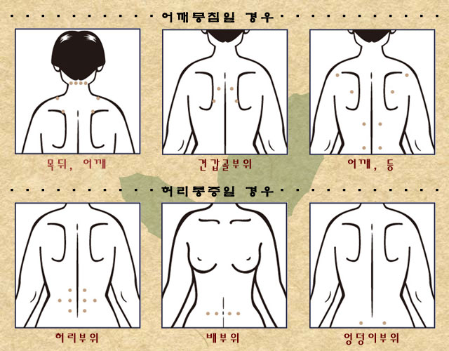 어깨뭉침일 경우, 허리통증일 경우