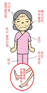 아토피나 과민한 피부 등의 가려움부터, 몸을 움직이지 못하는 환자들의 가벼운 욕창까지.